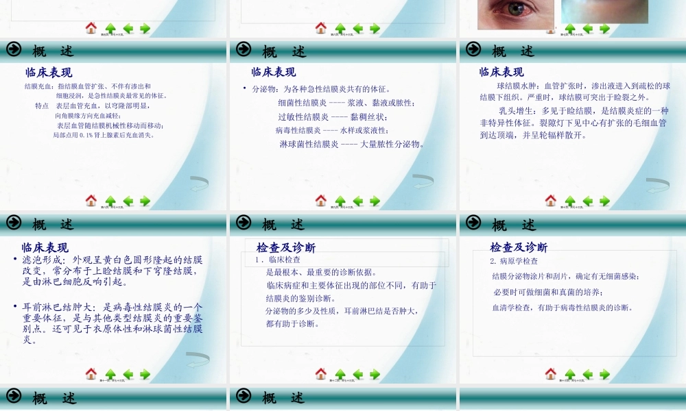 5第五节-结膜病.pptx