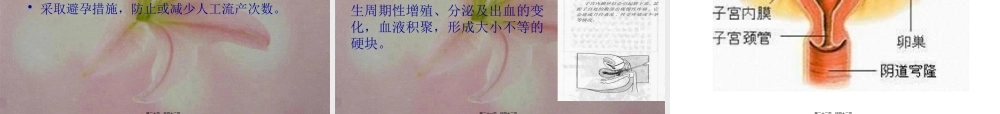 6-4-妇科病.pptx