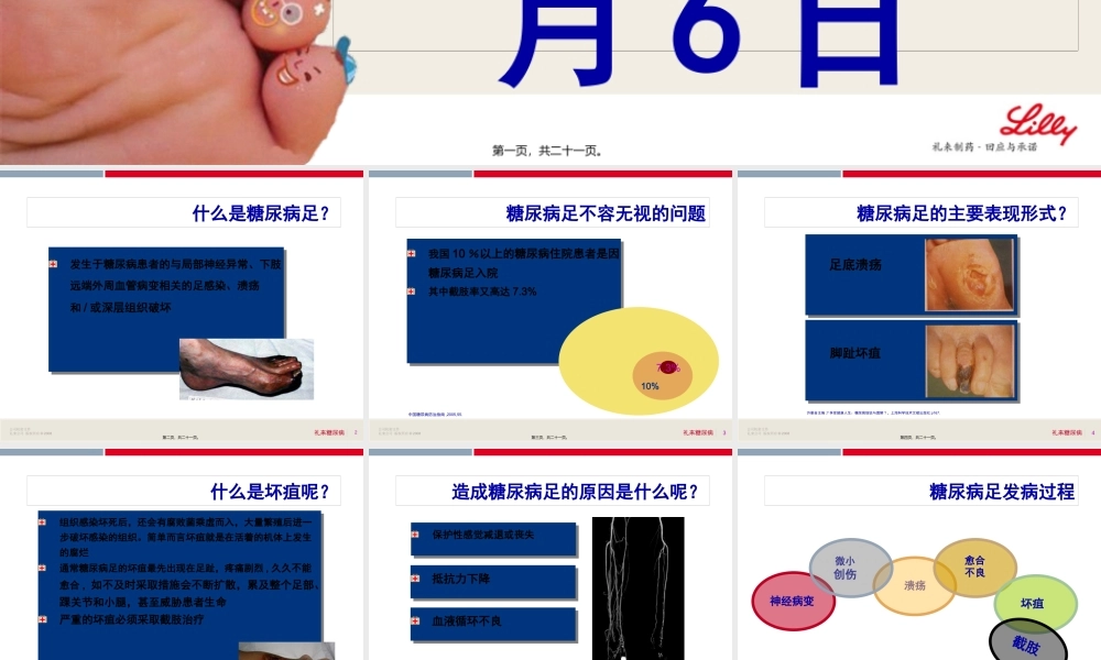 6糖尿病足赵小涛.pptx
