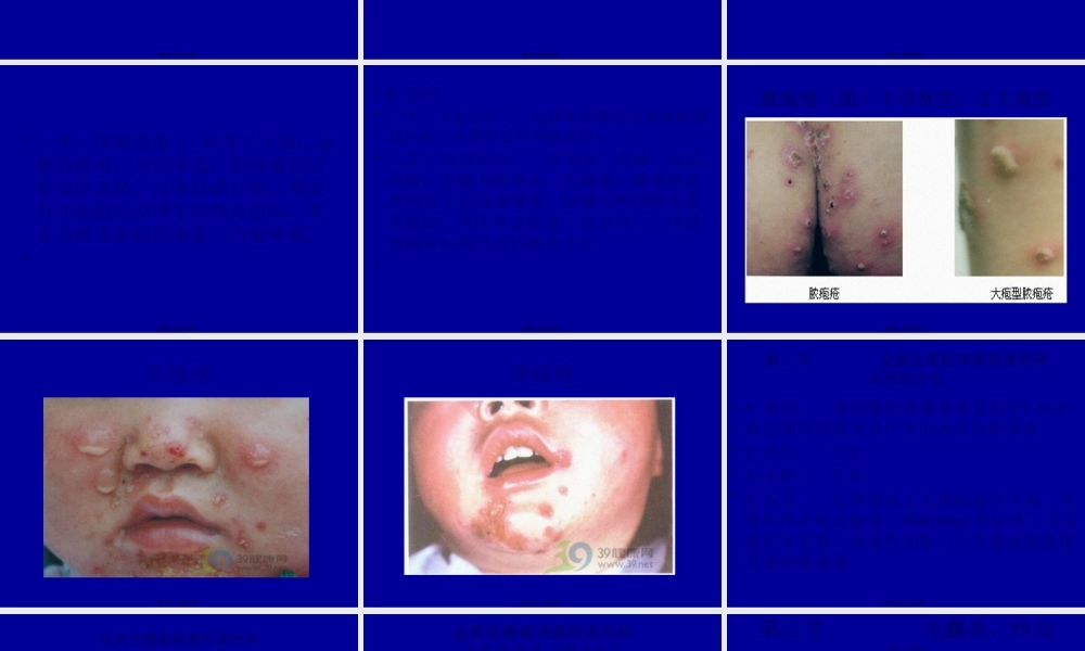 6细菌性皮肤病.pptx