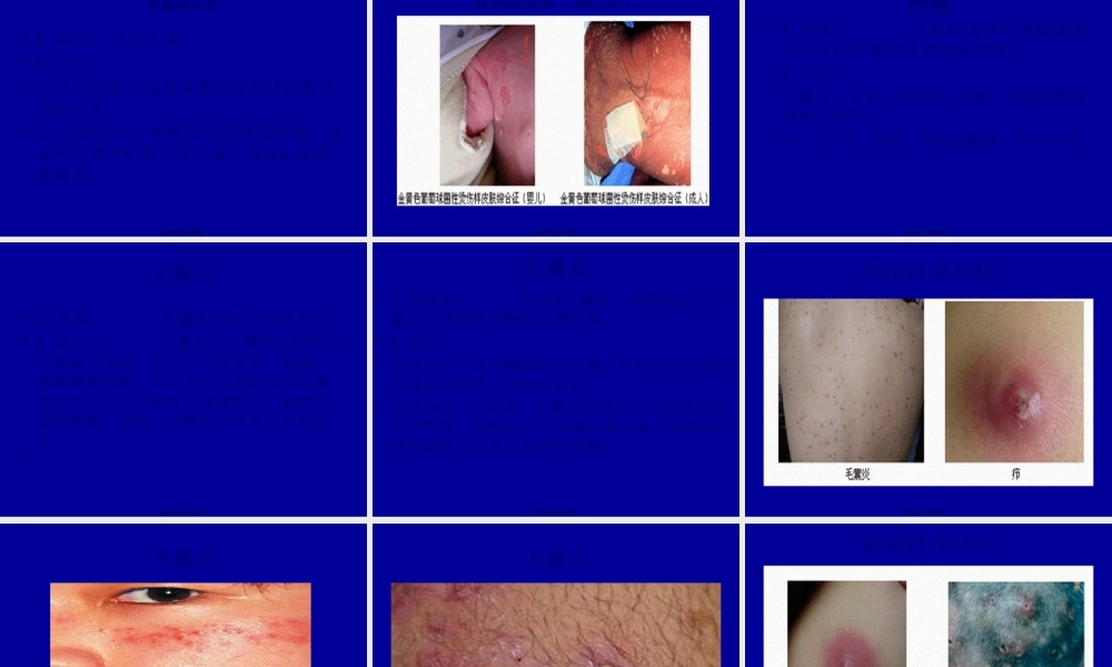 6细菌性皮肤病.pptx