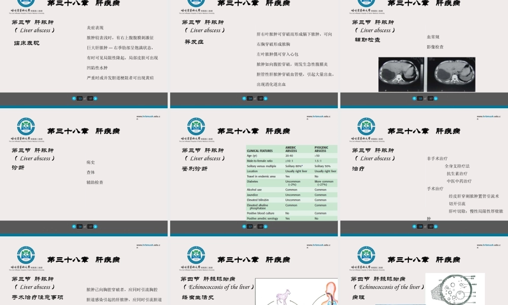 75内科-肝疾病及门脉高压(1).ppt