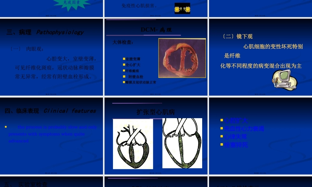 7扩张型心肌病幻灯.pptx