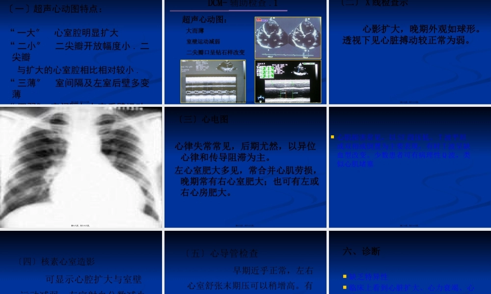 7扩张型心肌病幻灯.pptx