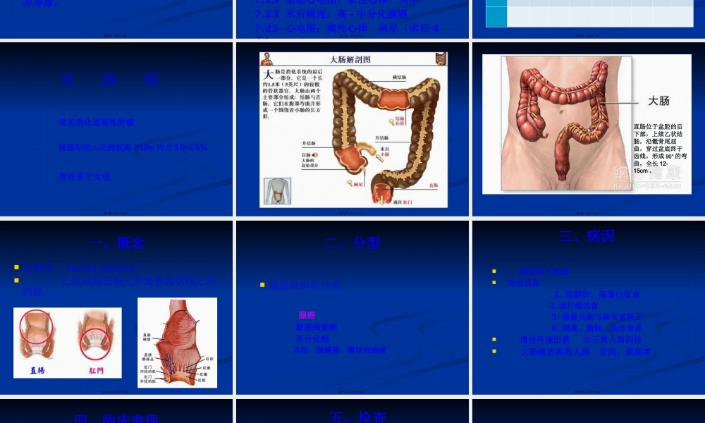 7月份—直肠.pptx