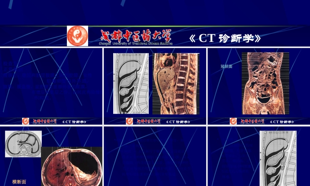 7腹膜腔、腹膜后CT检查.pptx