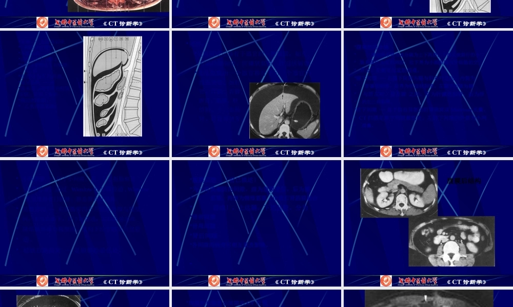 7腹膜腔、腹膜后CT检查.pptx