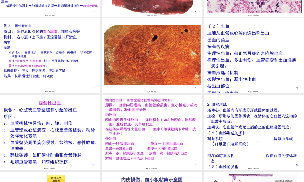 8局部血液循环障碍.pptx
