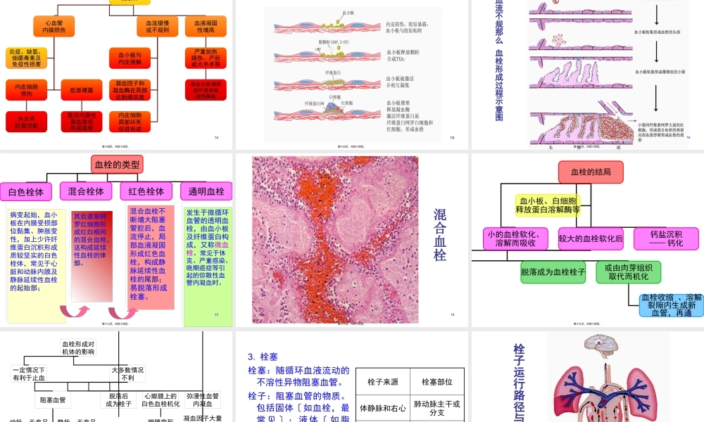 8局部血液循环障碍.pptx