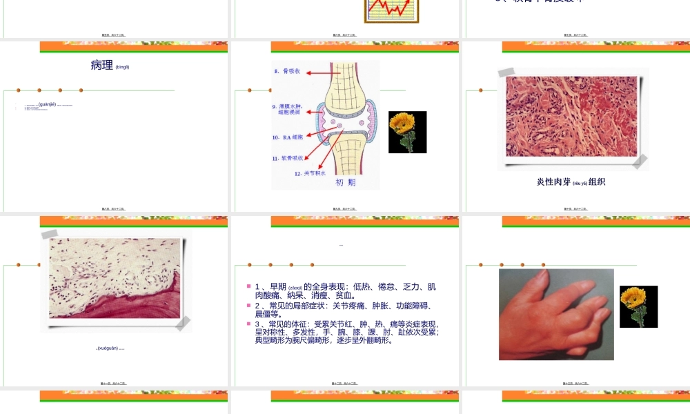 2022年医学专题—类风湿关节炎(rheumatoidarthritis-RA)是一种以关节病变.ppt