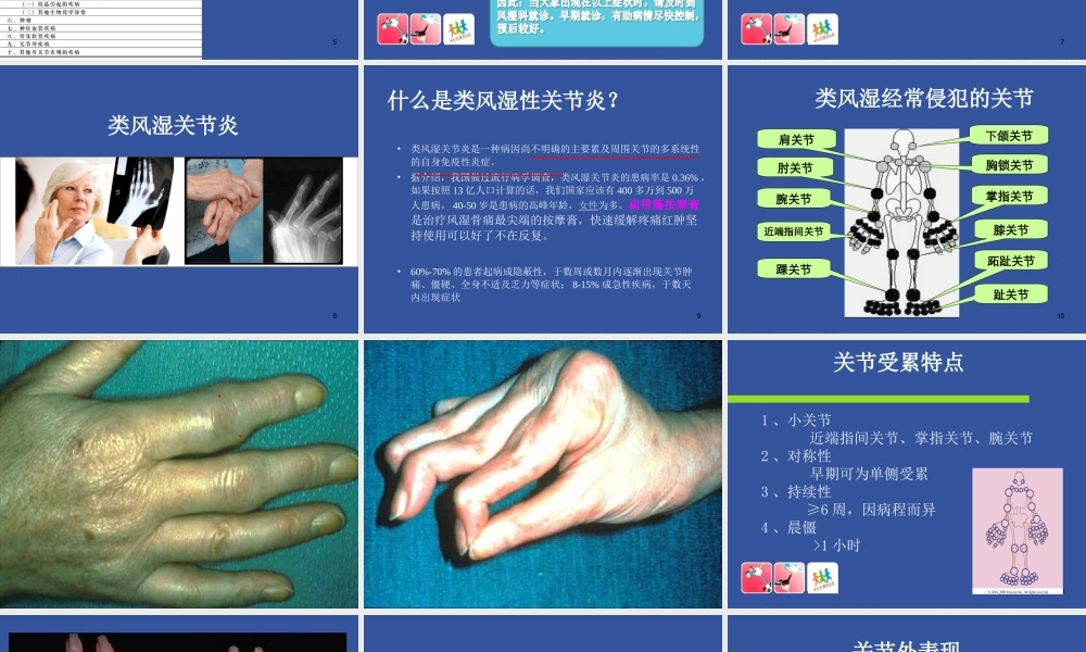 8风湿免疫科-风湿病的锻炼方法(1).ppt
