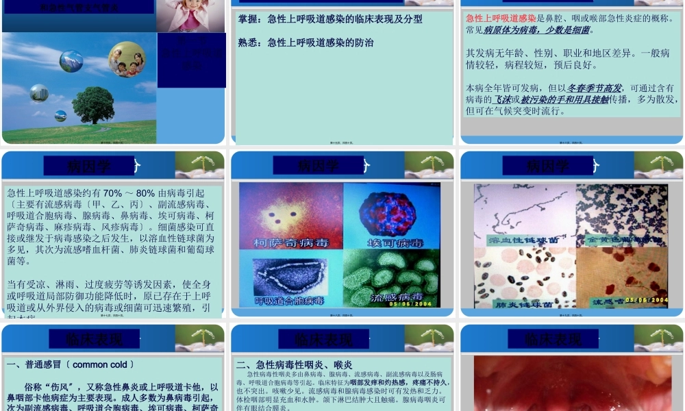 9.13急性上呼吸道感染.pptx