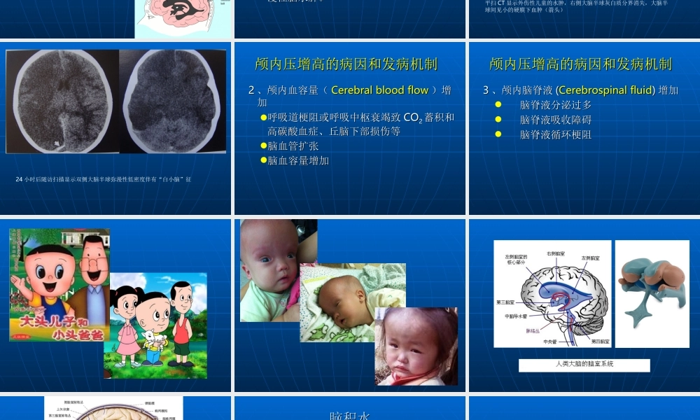 94神经科-颅内压增高与脑疝(1).ppt