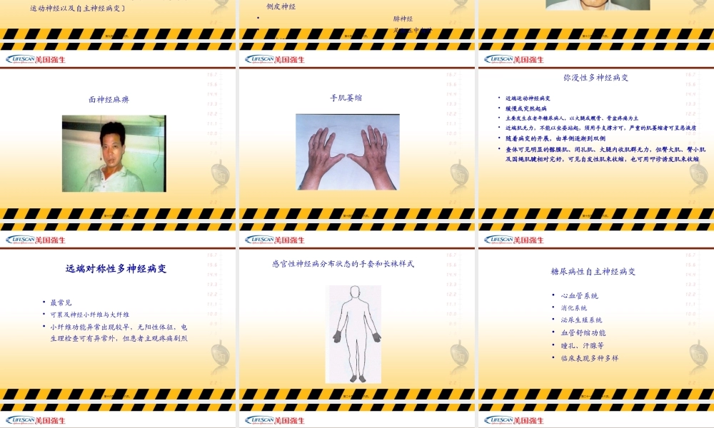 A3-07-糖尿病神经病变尤传一.pptx