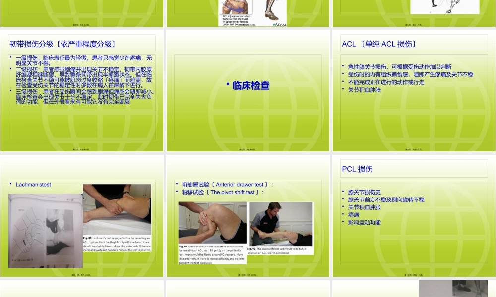 ACL-PCL术后康复.pptx