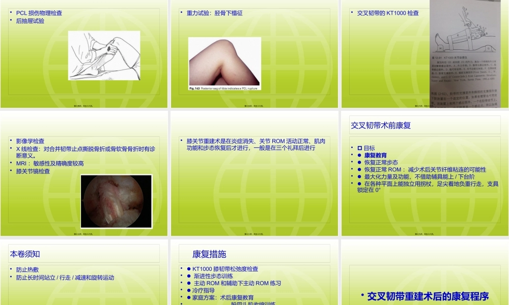 ACL-PCL术后康复.pptx