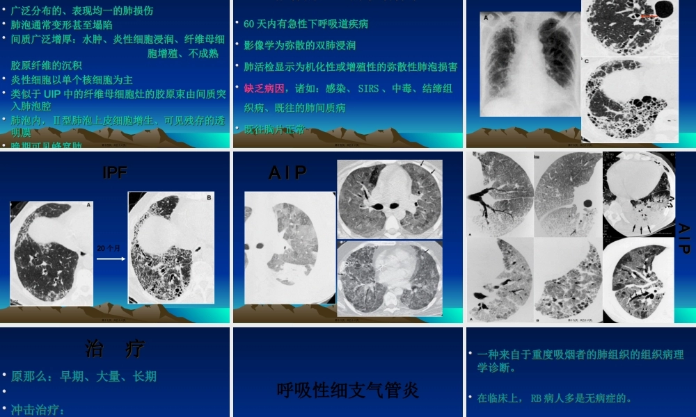 AIP急性间质性肺病.pptx