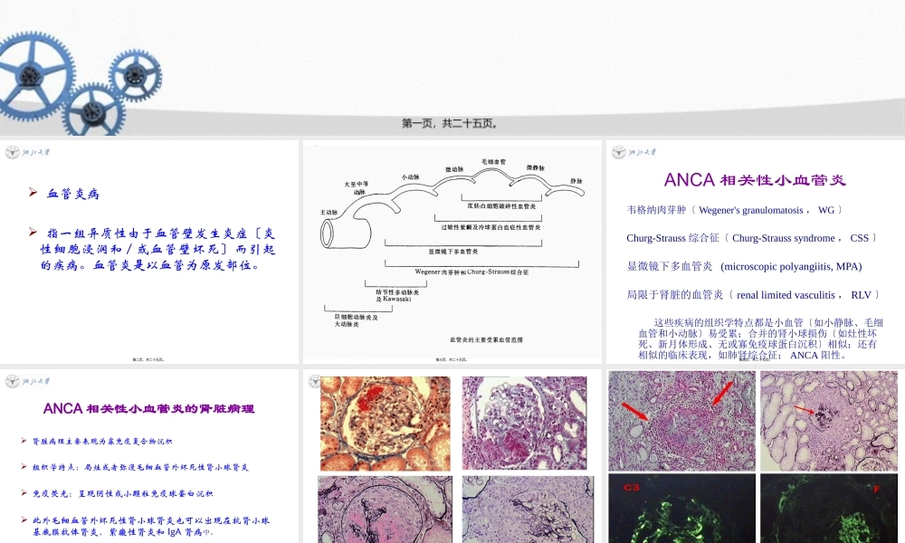 ANCA相关性血管炎的诊治进展.pptx
