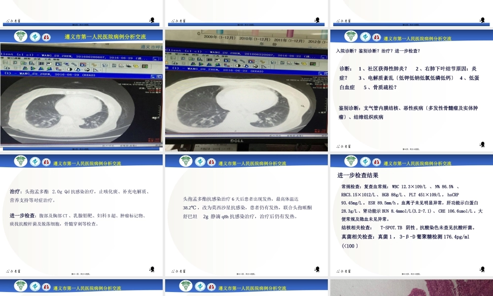 ANCA相关性血管炎病例分析.pptx