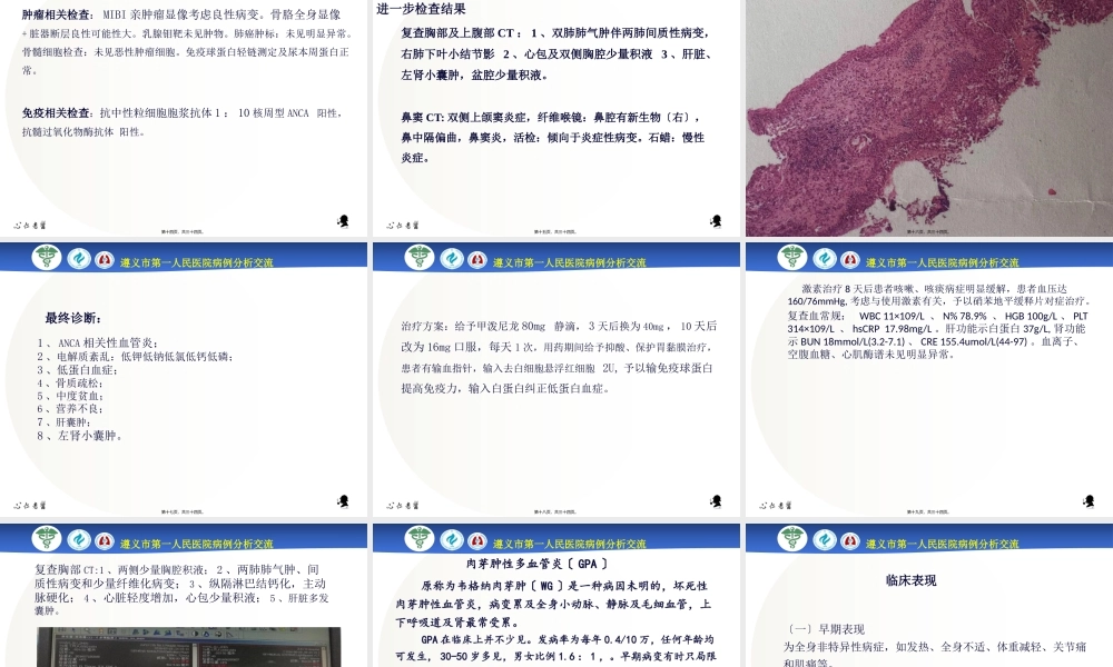 ANCA相关性血管炎病例分析.pptx