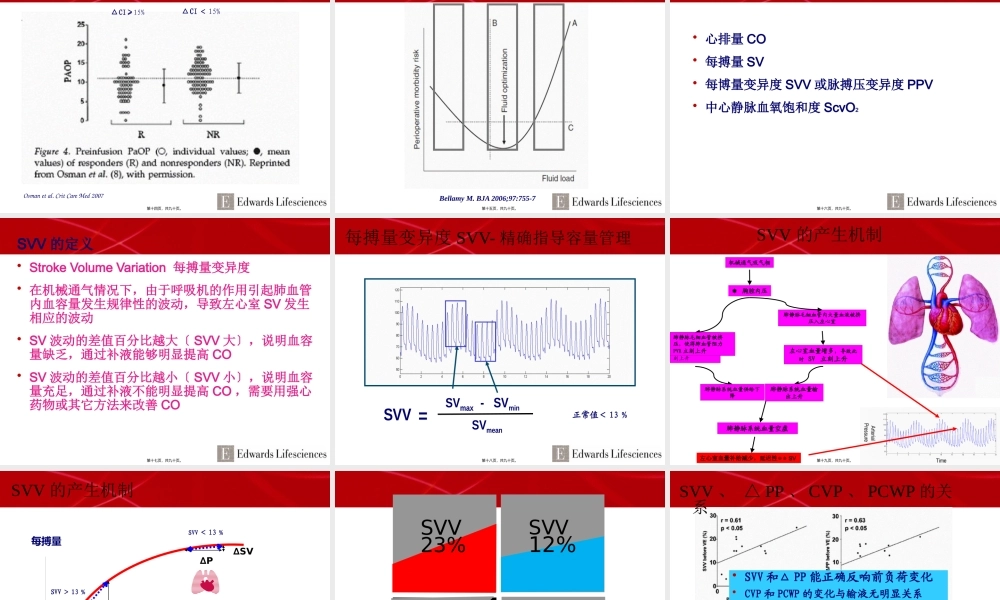 APCO血流动力学监测.pptx