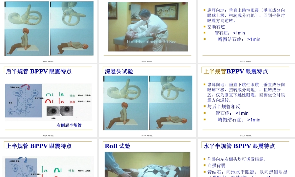 BPPV诊治.pptx