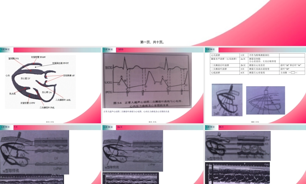 B心脏M超资料.pptx