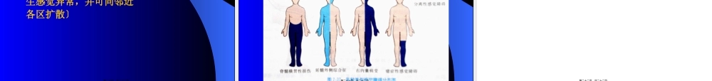 B感觉障碍.pptx