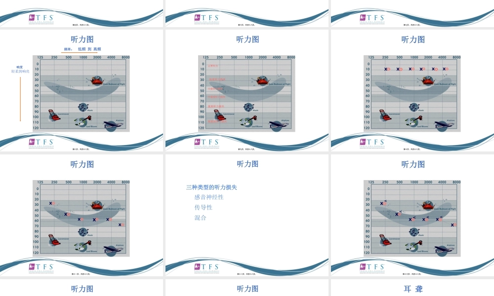 CIEP讲稿---人工耳蜗知识入门.pptx