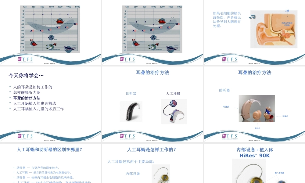 CIEP讲稿---人工耳蜗知识入门.pptx
