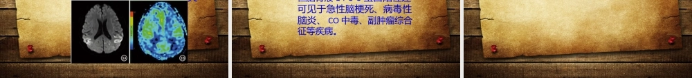 CJD介绍及病例.pptx