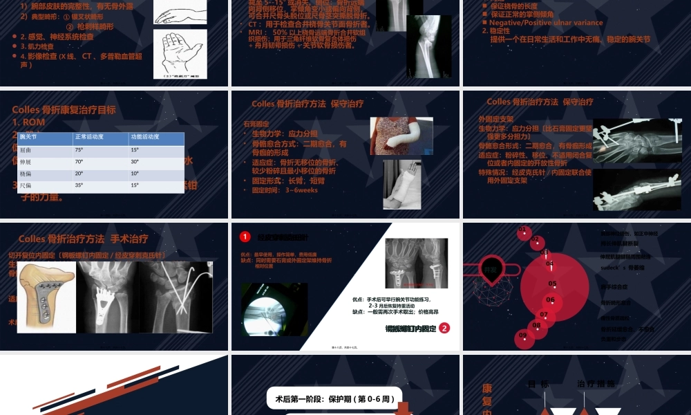 colles骨折术后康复.pptx