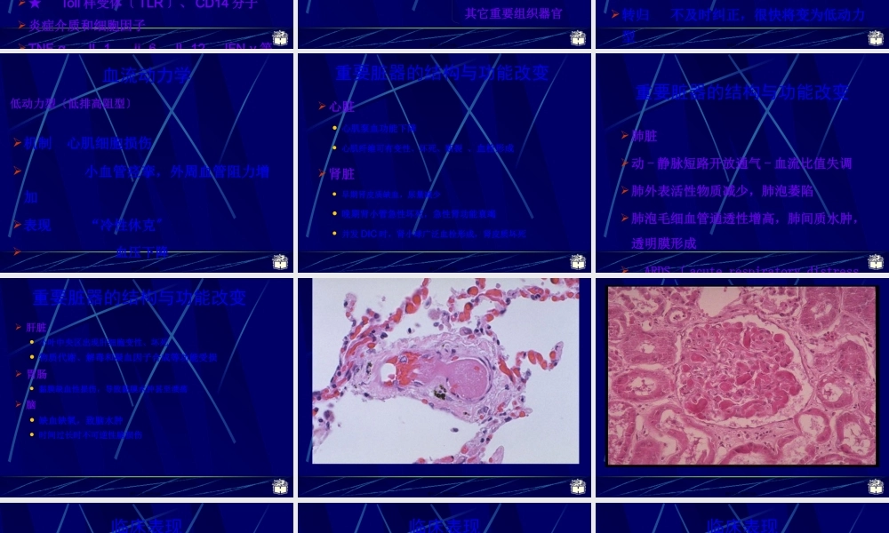 CP感染性休克.pptx