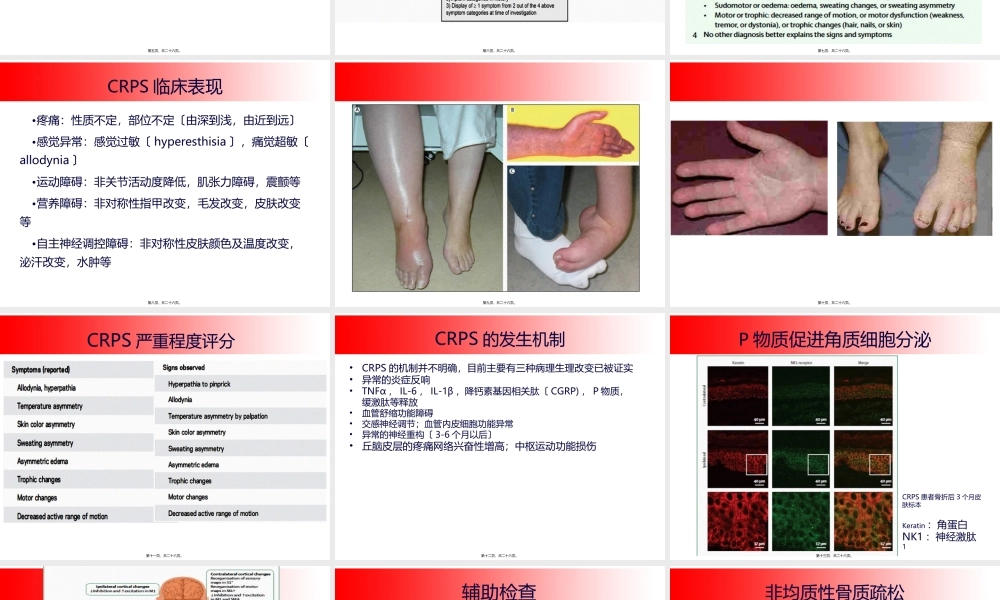 CRPS的诊治进展.ppt