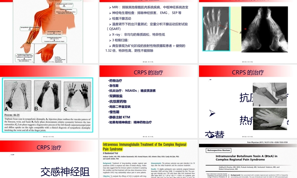 CRPS的诊治进展.ppt