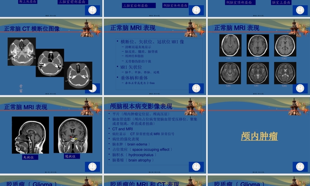 CT-MRI颅脑影像看片.pptx