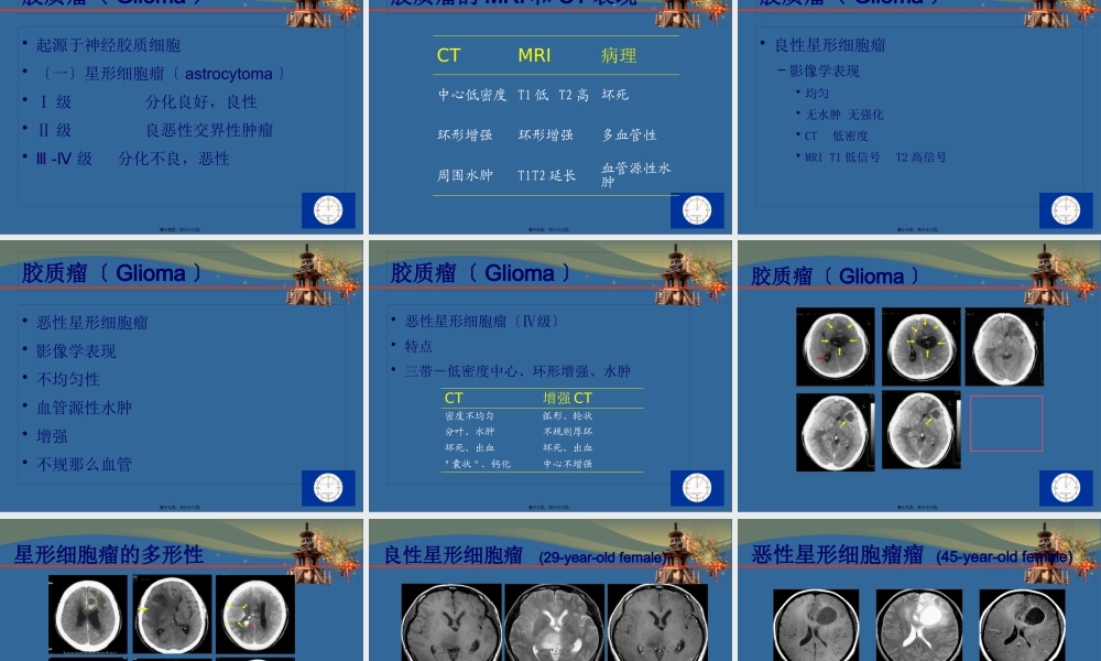 CT-MRI颅脑影像看片.pptx