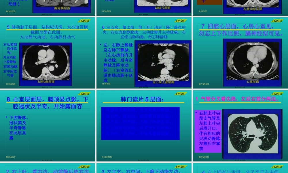 CT(胸部)读片(西京医院).pptx
