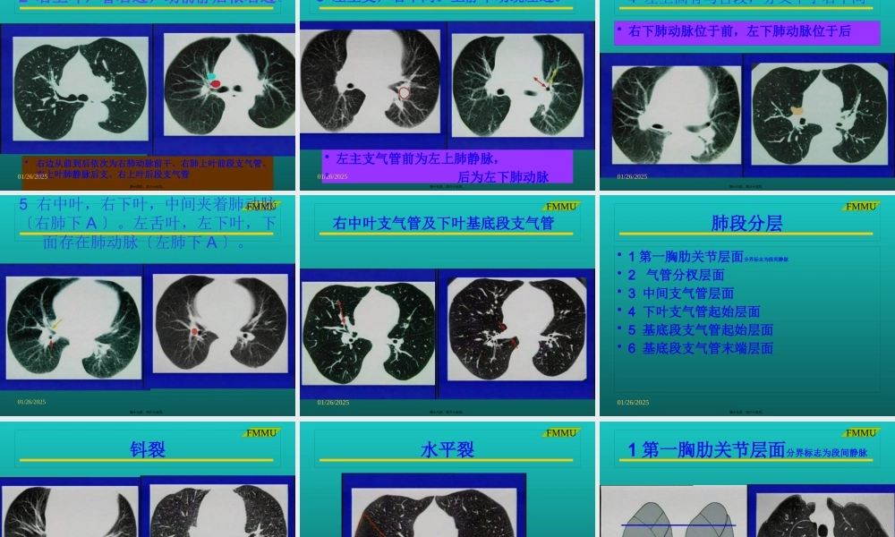 CT(胸部)读片(西京医院).pptx