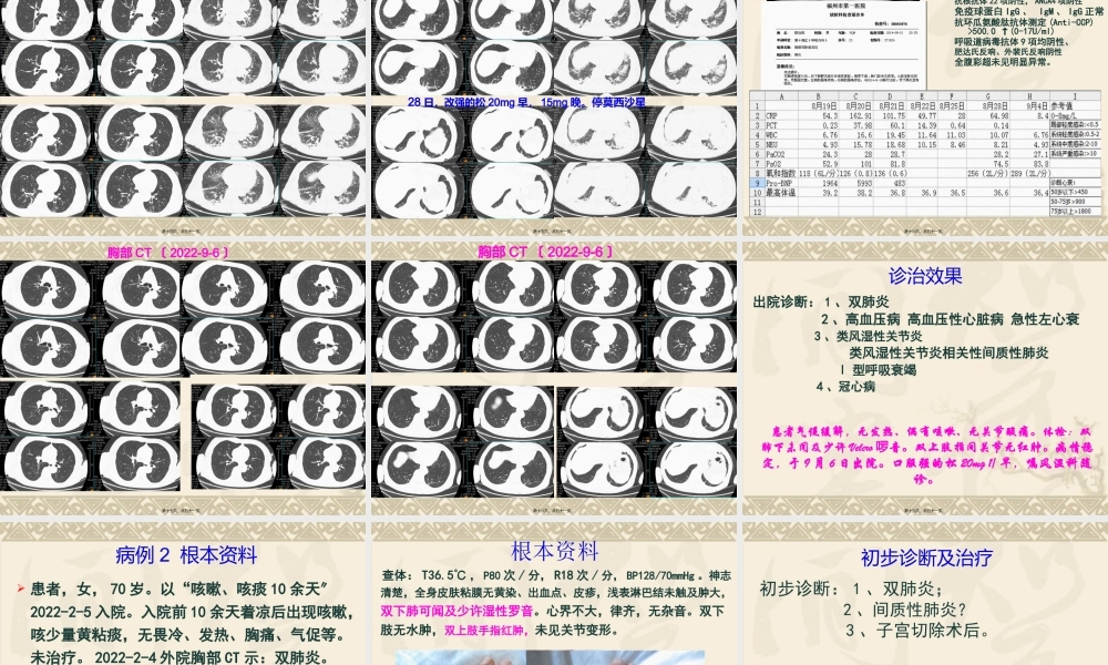 CTD-ILD(肺科20151007).pptx