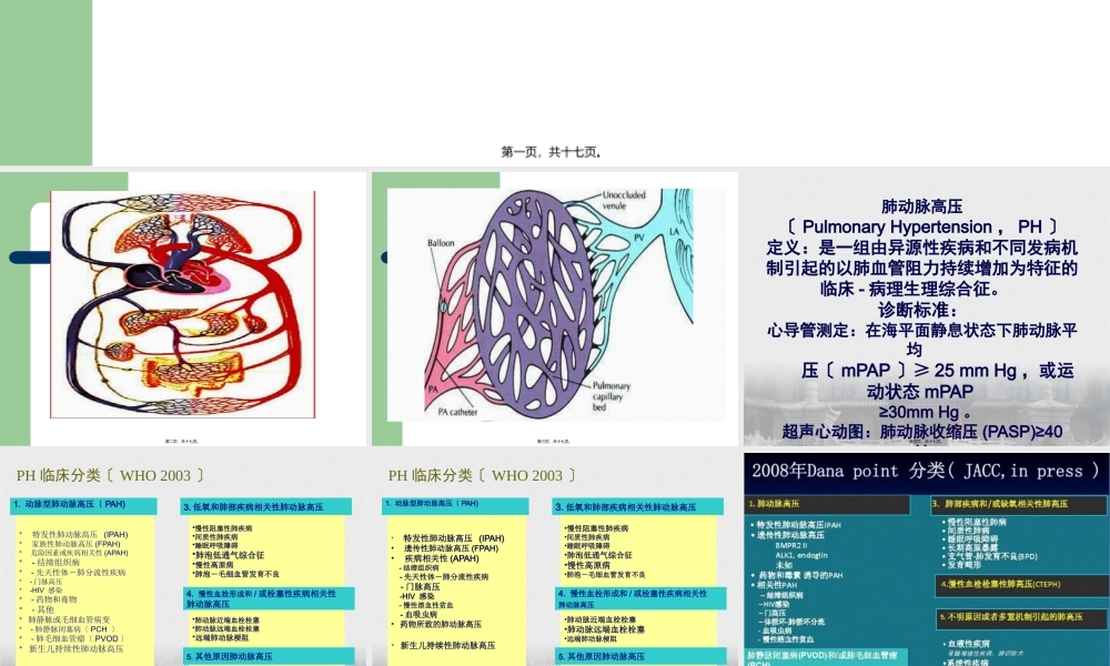 CTD-肺动脉高压.pptx