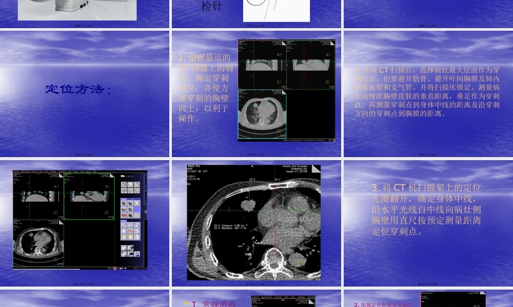 CT导引下肺穿刺活检术.pptx