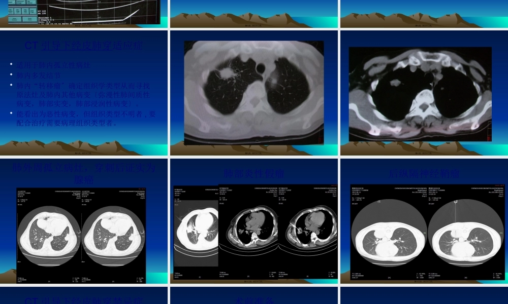 CT引导下经皮肺穿活检.pptx