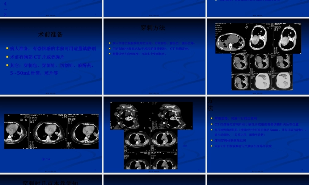 CT引导下肺穿刺活检术.pptx