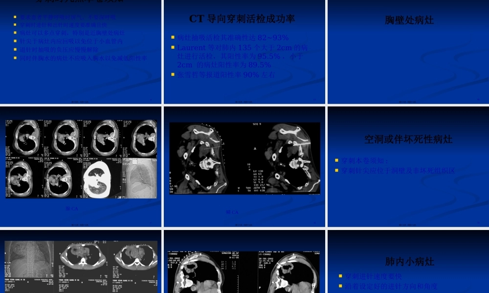 CT引导下肺穿刺活检术.pptx
