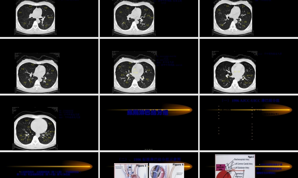 CT肺叶分段及纵膈淋巴结分组.ppt