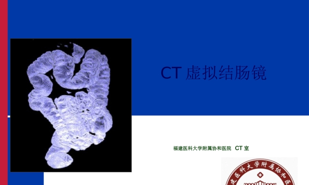 CT虚拟结肠镜.pptx