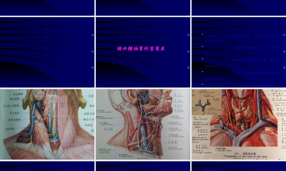 cvp深静脉置管术.pptx