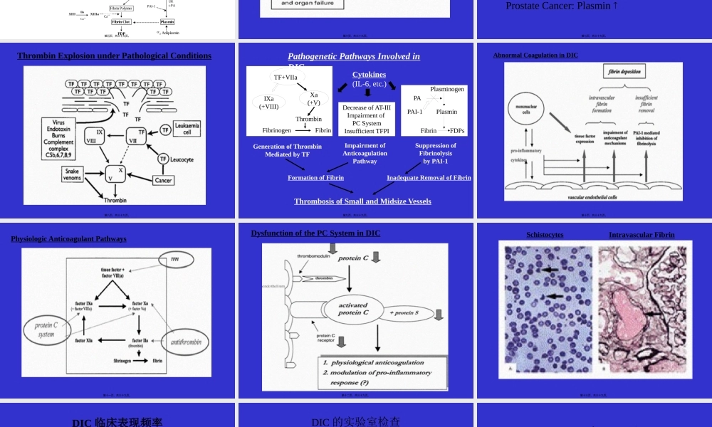 DIC弥漫性血管内凝血-北京协和医院血液科.pptx