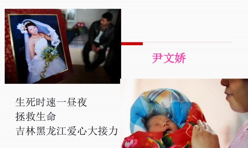 DIC(弥散性血管内凝血).pptx